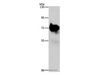 Western Blot analysis of Mouse brain tissue using SYN1 Polyclonal Antibody at dilution of 1:750