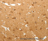 Immunohistochemistry of paraffin-embedded Human brain tissue using MAP1B  Polyclonal Antibody at dilution 1:60