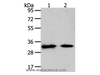 Western Blot analysis of Mouse heart and muscle tissue using SLC25A4 Polyclonal Antibody at dilution of 1:400