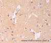 Immunohistochemistry of paraffin-embedded Human brain using ADCY1 Polyclonal Antibody at dilution of 1:60