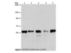 Western Blot analysis of Hela, Jurkat, 293T and K562 cell, Mouse testis tissue using ARIH2 Polyclonal Antibody at dilution of 1:550
