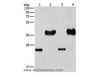 Western Blot analysis of Mouse liver tissue and k562 cell, hela and 293T cell using LIN28B  Polyclonal Antibody at dilution of 1:550