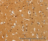 Immunohistochemistry of paraffin-embedded Human brain  tissue using PFKFB1 Polyclonal Antibody at dilution 1:60
