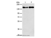 Western Blot analysis of A431 and Huvec cell using THBS1 Polyclonal Antibody at dilution of 1:250