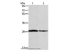 Western Blot analysis of Human chromaffin cell tumor tissue and lovo cell using SPR Polyclonal Antibody at dilution of 1:1500