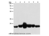 Western Blot analysis of Human fetal muscle and fetal lung tissue, Human leiomyosarcoma tissue, Mouse lung and heart tissue,  NIH/3T3 cell using CAV1 Polyclonal Antibody at dilution of 1:550