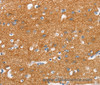 Immunohistochemistry of paraffin-embedded Human brain tissue using SNCA Polyclonal Antibody at dilution 1:30
