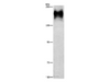 Western Blot analysis of HepG2 cell using ATP7A  Polyclonal Antibody at dilution of 1:800