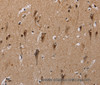 Immunohistochemistry of paraffin-embedded Human brain  using GTF2I Polyclonal Antibody at dilution of 1:40