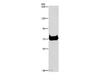 Western Blot analysis of Mouse pancreas tissue using CEL Polyclonal Antibody at dilution of 1:500