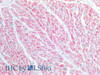 Immunohistochemistry of paraffin-embedded Human heart tissue using BST1 Polyclonal Antibody at dilution of 1:100(Elabscience® Product Detected by Lifespan).