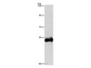 Western Blot analysis of Human placenta tissue using CTSC Polyclonal Antibody at dilution of 1:1000