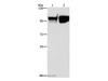 Western Blot analysis of Hela and raji cell using CD54 Polyclonal Antibody at dilution of 1:350