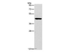 Western Blot analysis of Mouse brain tissue using B3GAT1 Polyclonal Antibody at dilution of 1:400