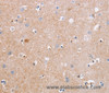 Immunohistochemistry of paraffin-embedded Human brain tissue using CDC7 Polyclonal Antibody at dilution 1:50