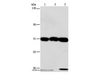 Western Blot analysis of 293T, hepG2 and A549 cell using CKAP4 Polyclonal Antibody at dilution of 1:1250