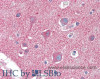 Immunohistochemistry of paraffin-embedded Brain, Cortex tissue using CLTC Polyclonal Antibody at dilution of 1:60(Elabscience® Product Detected by Lifespan).