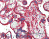 Immunohistochemistry of paraffin-embedded Placenta tissue using CLTC Polyclonal Antibody at dilution of 1:60(Elabscience® Product Detected by Lifespan).