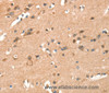 Immunohistochemistry of paraffin-embedded Human brain  using CRELD1 Polyclonal Antibody at dilution of 1:40