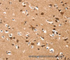 Immunohistochemistry of paraffin-embedded Human brain  using DAAM1 Polyclonal Antibody at dilution of 1:50