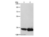 Western Blot analysis of Hela and hepG2 cell using AIMP1 Polyclonal Antibody at dilution of 1:400