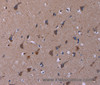 Immunohistochemistry of paraffin-embedded Human brain tissue using TUBGCP2 Polyclonal Antibody at dilution 1:50