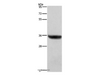 Western Blot analysis of Human placenta tissue  using HSD17B1 Polyclonal Antibody at dilution of 1:700