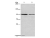 Western Blot analysis of 293T and Hela cell using ICAM5 Polyclonal Antibody at dilution of 1:500