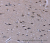 Immunohistochemistry of paraffin-embedded Human brain  tissue using ID3 Polyclonal Antibody at dilution 1:40