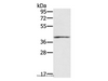 Western Blot analysis of Mouse muscle tissue using IFNGR2 Polyclonal Antibody at dilution of 1:200