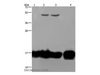 Western Blot analysis of A549 and K562 cell, Raji cell and Human fetal intestine tissue using IL17C Polyclonal Antibody at dilution of 1:250