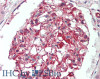 Immunohistochemistry of paraffin-embedded Kidney tissue using IL17RB Polyclonal Antibody at dilution of 1:120 (Elabscience® Product Detected by Lifespan).