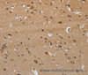 Immunohistochemistry of paraffin-embedded Human brain  tissue using ITPR3 Polyclonal Antibody at dilution 1:40