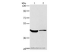 Western Blot analysis of Hela cell and Mouse kidney tissue using KCNA7 Polyclonal Antibody at dilution of 1:550