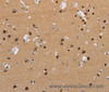 Immunohistochemistry of paraffin-embedded Human brain  using KCNG4 Polyclonal Antibody at dilution of 1:40