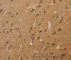 Immunohistochemistry of paraffin-embedded Human brain  tissue using KCNN4 Polyclonal Antibody at dilution 1:50