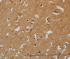 Immunohistochemistry of paraffin-embedded Human brain  tissue using KIF4A Polyclonal Antibody at dilution 1:40