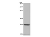 Western Blot analysis of Mouse spleen tissue using KLK14 Polyclonal Antibody at dilution of 1:300