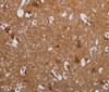 Immunohistochemistry of paraffin-embedded Human brain tissue using LIMK1 Polyclonal Antibody at dilution 1:40