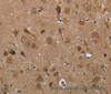 Immunohistochemistry of paraffin-embedded Human brain  tissue using LLGL1 Polyclonal Antibody at dilution 1:40