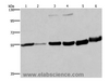 Western Blot analysis of Human fetal liver and testis tissue, 293T and A172 cell, Mouse brain and Human fetal brain tissue using MCHR1 Polyclonal Antibody at dilution of 1:350