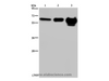 Western Blot analysis of 823 cell, Mouse brain and Human fetal brain tissue using MMP20 Polyclonal Antibody at dilution of 1:400