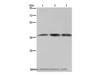 Western Blot analysis of 293T and LoVo cell, Human brain malignant glioma tissue using CAB39 Polyclonal Antibody at dilution of 1:450