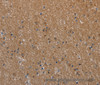 Immunohistochemistry of paraffin-embedded Human brain  tissue using NAA25 Polyclonal Antibody at dilution 1:40