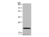 Western Blot analysis of Raji cell using NDUFAF4 Polyclonal Antibody at dilution of 1:300