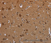 Immunohistochemistry of paraffin-embedded Mouse brain using MYCN Polyclonal Antibody at dilution 1:35
