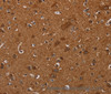 Immunohistochemistry of paraffin-embedded Human brain tissue using CYBB Polyclonal Antibody at dilution 1:40