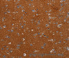 Immunohistochemistry of paraffin-embedded Human brain tissue using NOX3 Polyclonal Antibody at dilution 1:40