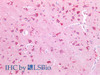 Immunohistochemistry of paraffin-embedded Human adrenal tissue using NPTX1 Polyclonal Antibody at dilution of 1:100(Elabscience® Product Detected by Lifespan).