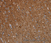 Immunohistochemistry of paraffin-embedded Human brain  tissue using DCAF6 Polyclonal Antibody at dilution 1:30